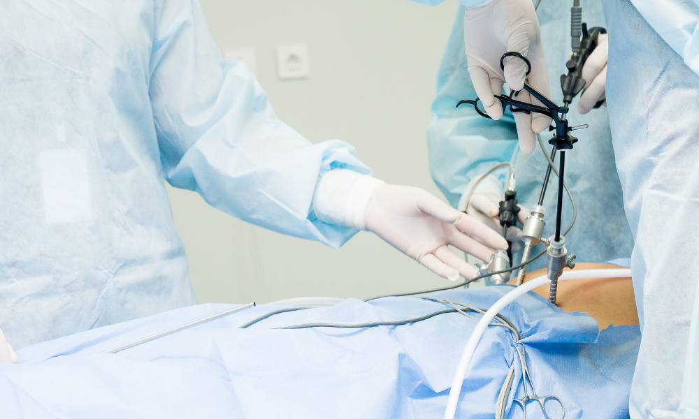 Laparoscopic Surgeries