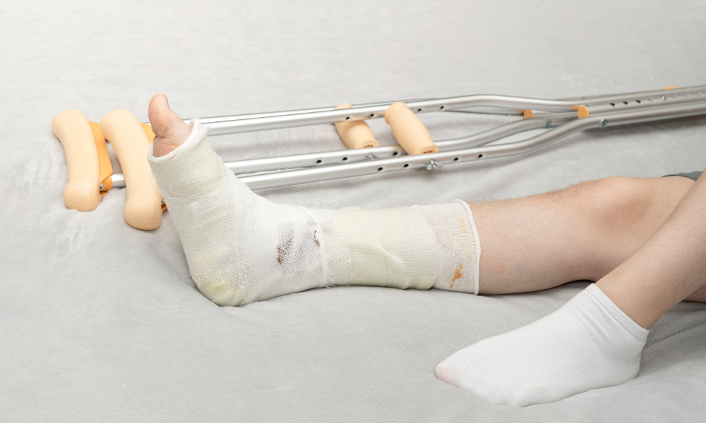 Orthopedic Trauma Care